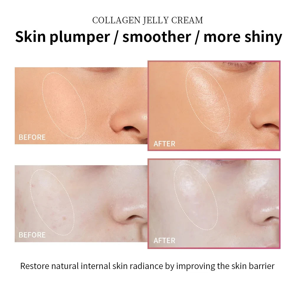 Collagen Jelly Cream for Daily Hydration